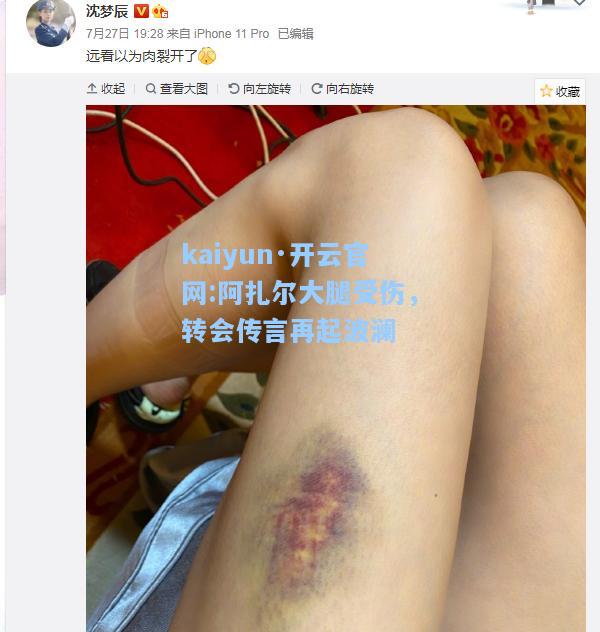 阿扎尔大腿受伤，转会传言再起波澜